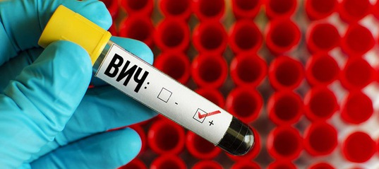 В Усть-Илимске и районе сложилась неблагополучная ситуация по ВИЧ-инфекции